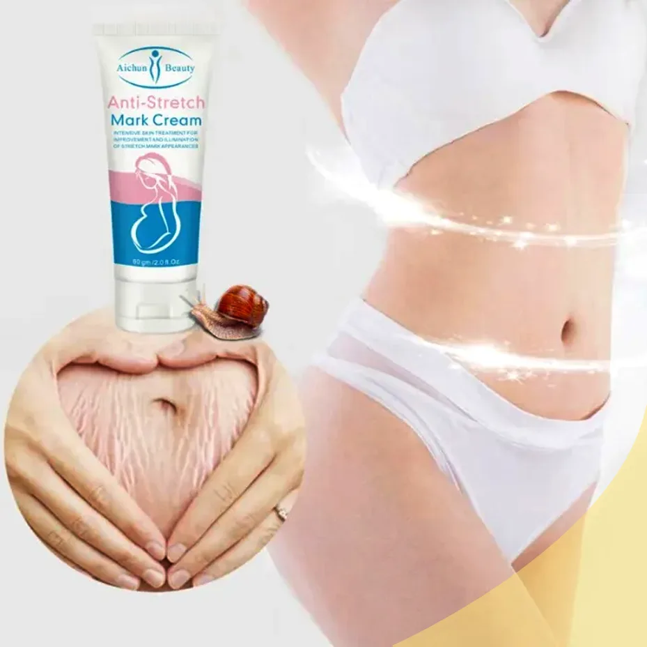 AICHUN BEAUTY Anti Stretch Mark Cream - Image 2