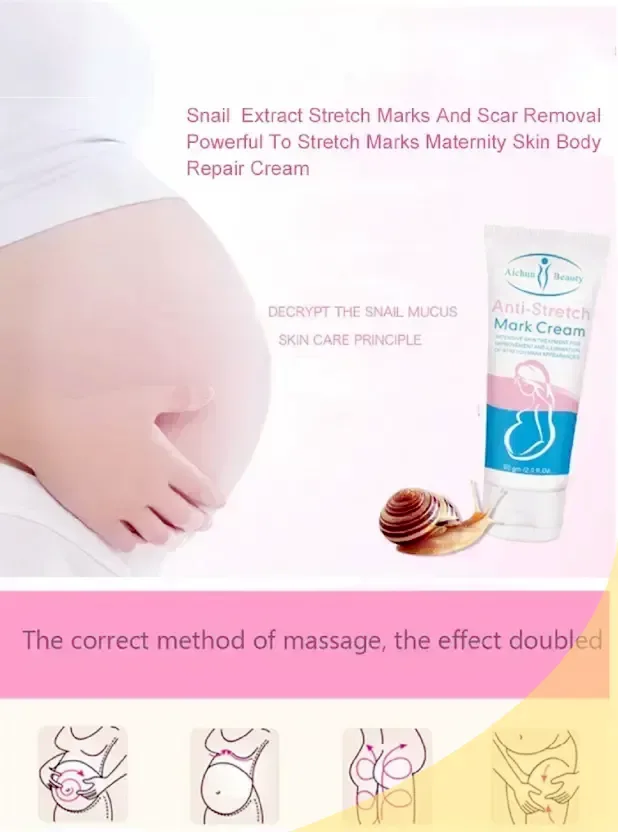 AICHUN BEAUTY Anti Stretch Mark Cream - Image 7
