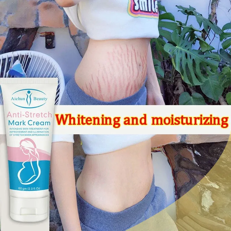 AICHUN BEAUTY Anti Stretch Mark Cream - Image 10